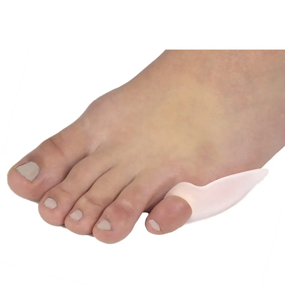 pinky toe bunion